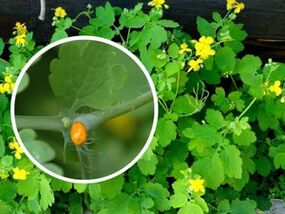 Celandine juice for the treatment of plantar warts.